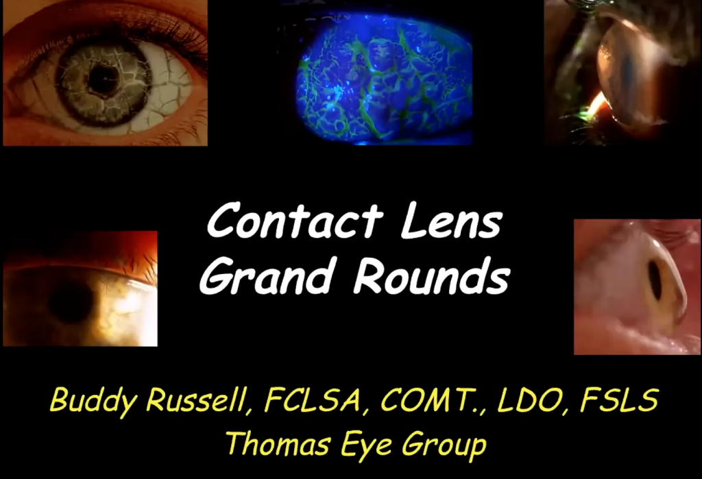Contact Lens Grand Rounds